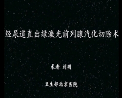 经尿道直出绿激光前列腺汽化切除术（术者：北京医院刘明教授）