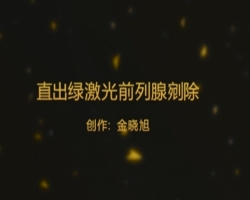 中原组-直出绿激光前列腺剜除术-金晓旭（偃师市中医院）.mep