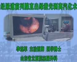 神州组-经尿道前列腺直出绿激光剥离汽化术-李连军（山东省立医院）